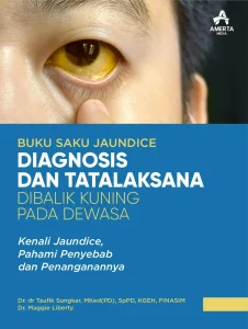 Diagnosis Dan Tatalaksana Dibalik Kuning Pada Dewasa (Kenali Jaundice, Pahami Penyebab dan Penanganannya)